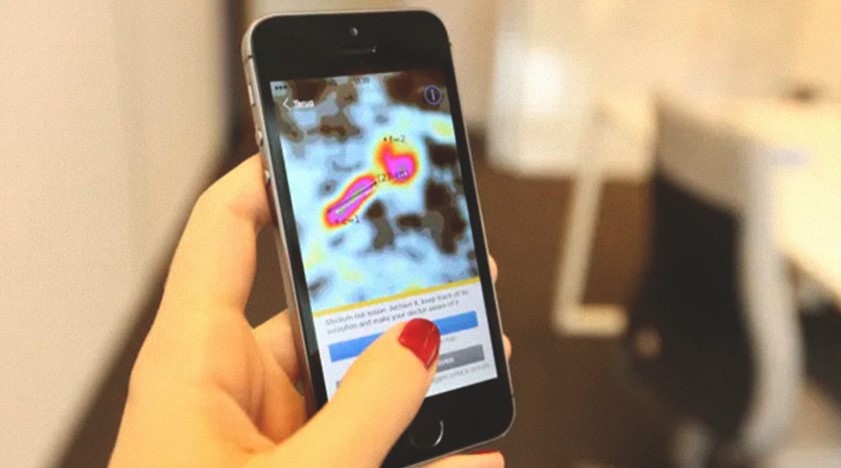 Una app para detectar el cáncer de piel 